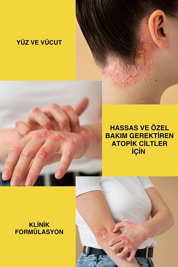 Naturaline Sülfax Kükürt Krem 100 Ml