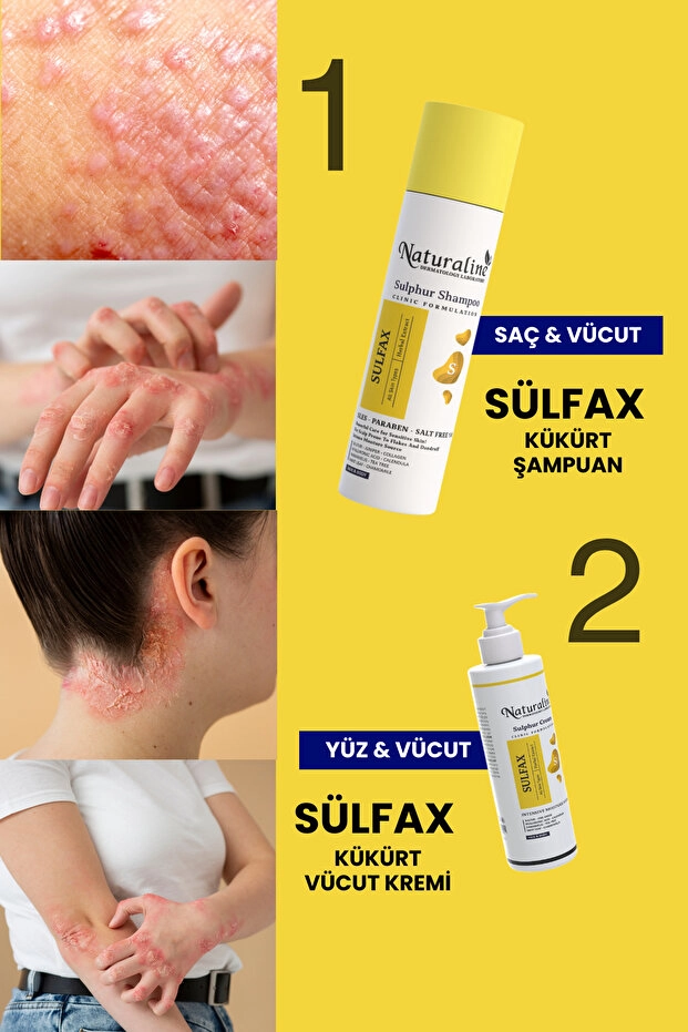 Naturaline Sülfax Kükürt Şampuanı – Saç Dökülmesi ve Kepeğe Karşı Etkili Bakım 200 Ml